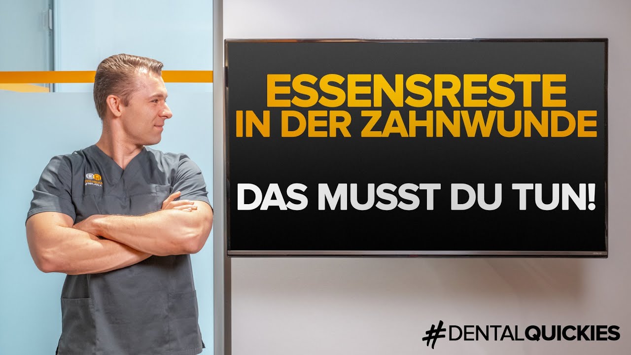 Essen in WUNDE nach WEISHEITSZAHNENTFERNUNG oder ZAHNEXTRAKTION 😖 Das kannst du tun! Inkl. Spültipps