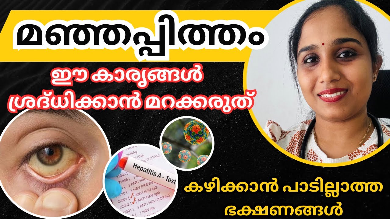 മഞ്ഞപ്പിത്തം ശ്രദ്ധിക്കേണ്ട കാര്യങ്ങൾ,കഴിക്കാൻപാടില്ലാത്തഭക്ഷണങ്ങൾ 
