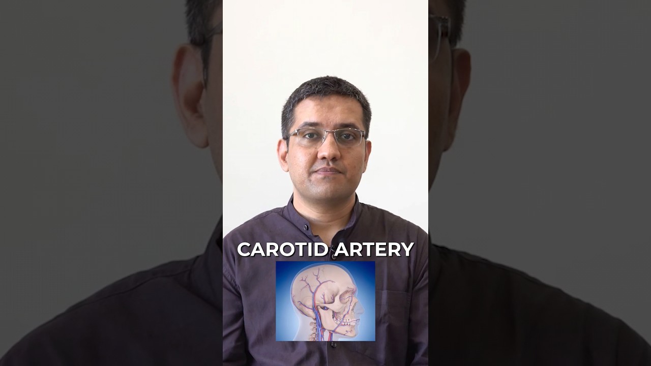 Treatment for Carotid Artery Issues 🤯