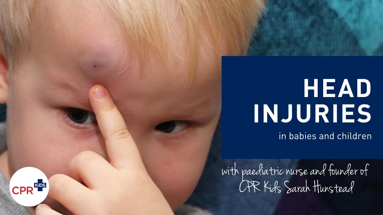 Head injuries in babies and children