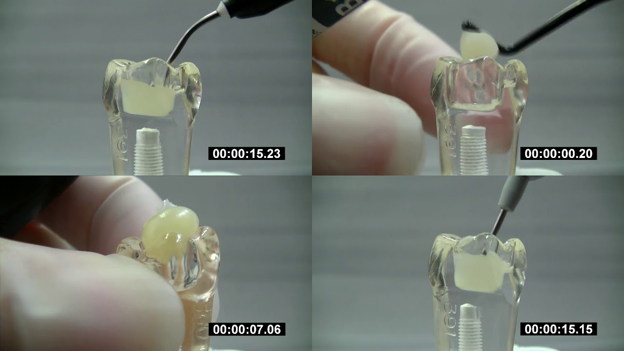 ESTELITE BULK FILL FLOW im Vergleich  | Tokuyama Dental