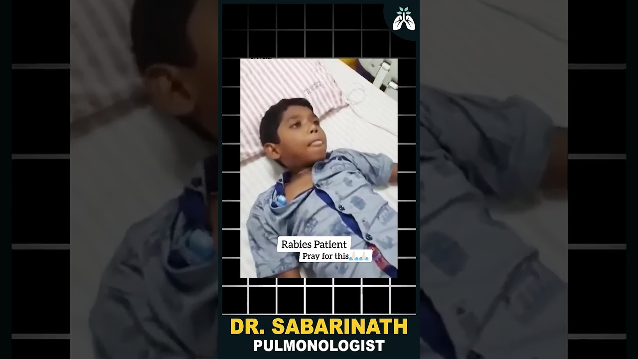 #rabies கான முக்கியமான அறிகுறிகள் | Dr Sabarinath Ravichandar Explains #awareness