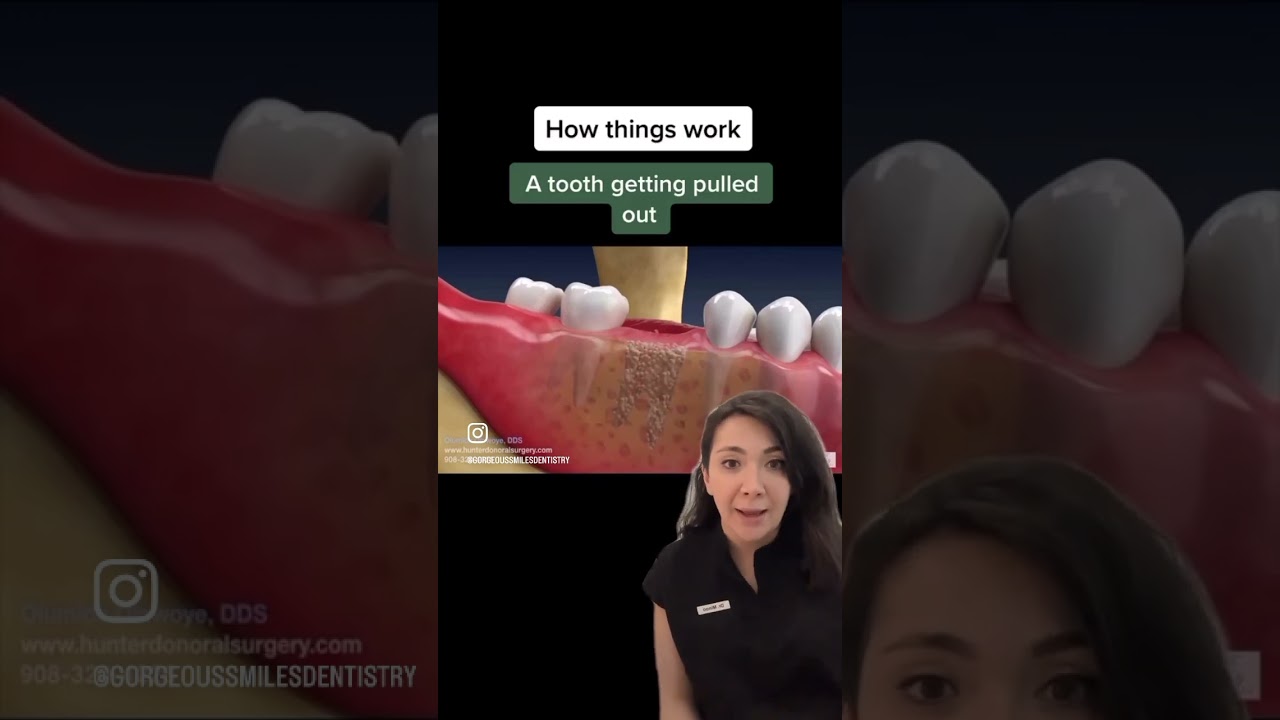 why do you need to have a bone graft done after removing a tooth⁉️