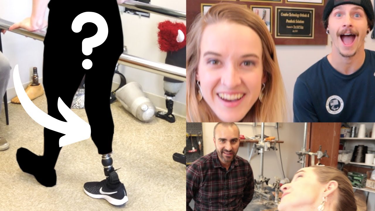 My NEW Prosthetic Leg (Direct) Socket - ft. Noah Elliot/Zach Harvey!
