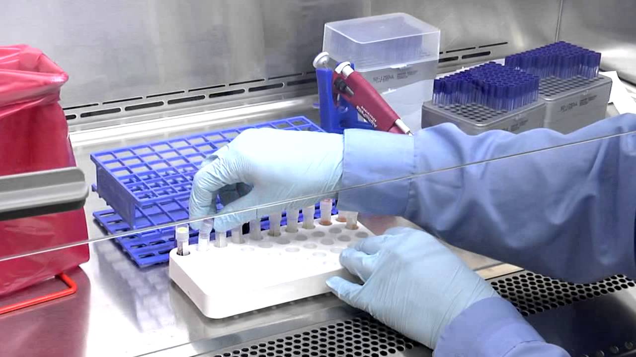 Blood Specimen Processing