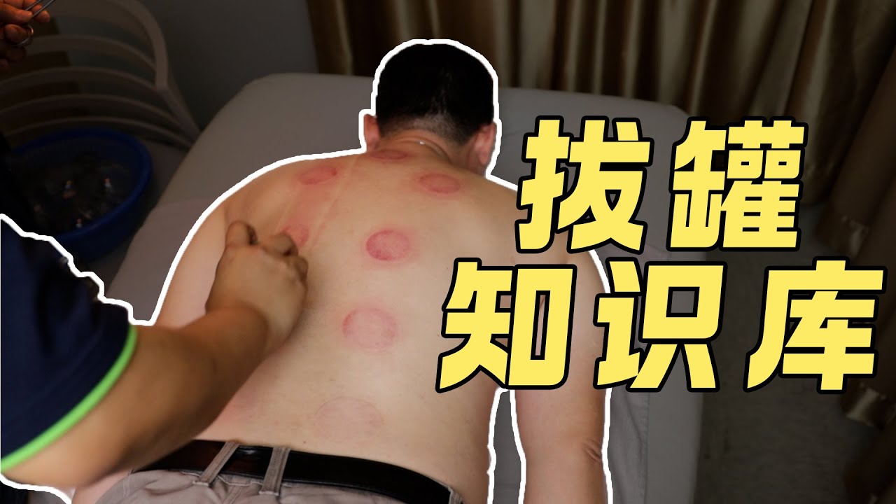 拔罐前后需要注意什么？强益堂中医专家教你正确使用拔罐！
