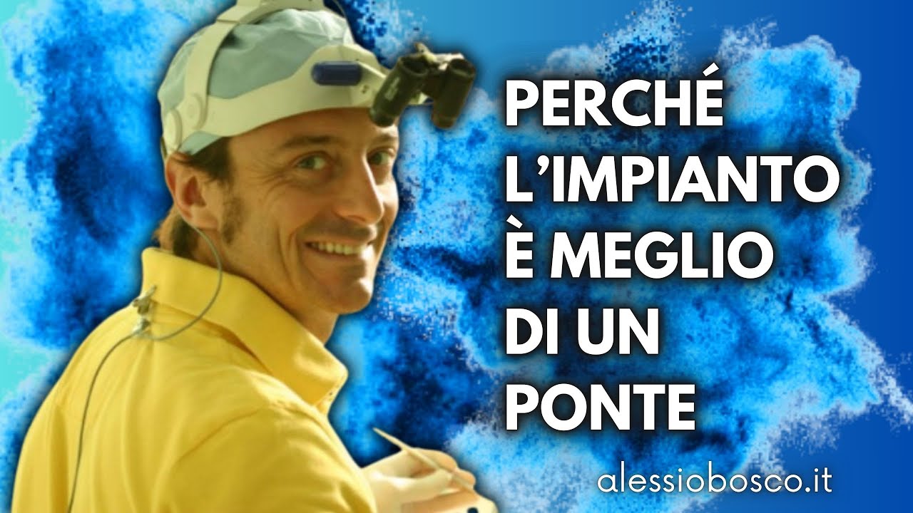 Perché L'IMPIANTO è MEGLIO di un PONTE