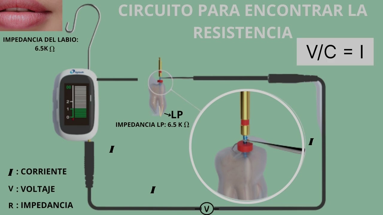 Uso clinico del Localizador AirPex.