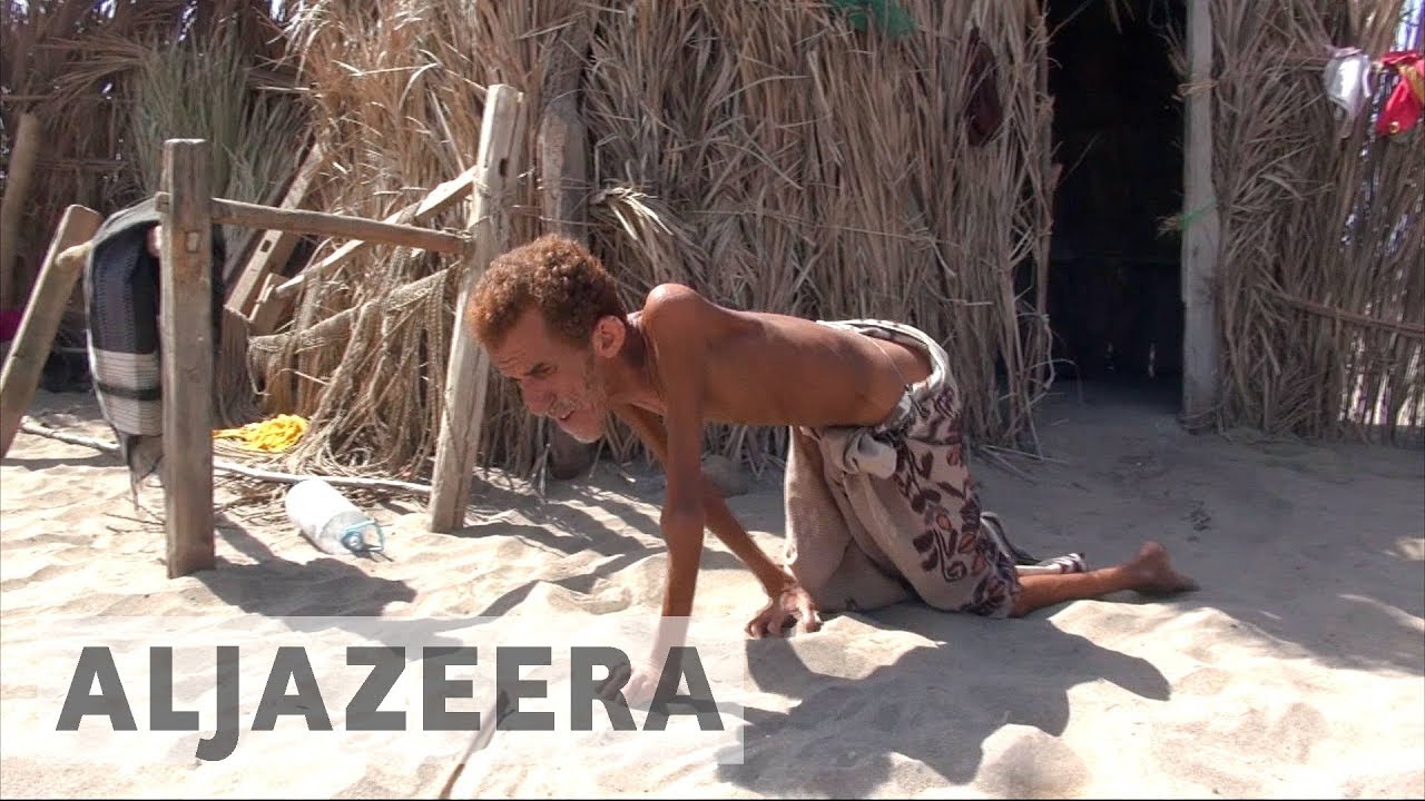 Yemen war: Millions face devastation, disease and famine