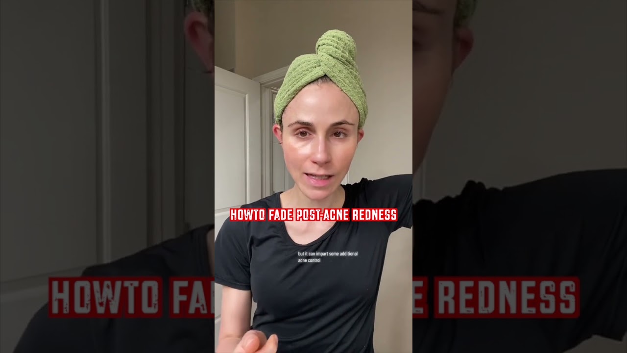 HOW TO FADE POST-ACNE REDNESS #dermatologist @DrDrayzday