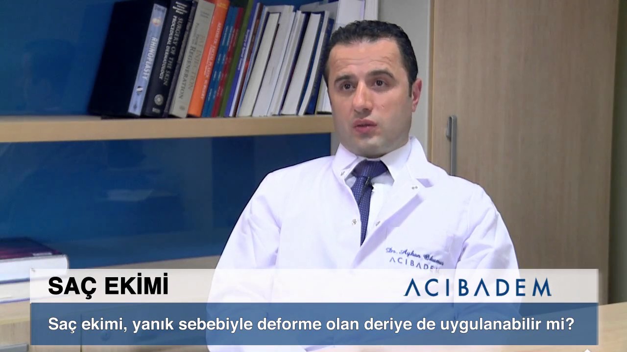 SA&Ccedil; EKİMİ YANIK SEBEBİYLE DEFORME OLAN DERİYE DE UYGULANABİLİR Mİ?