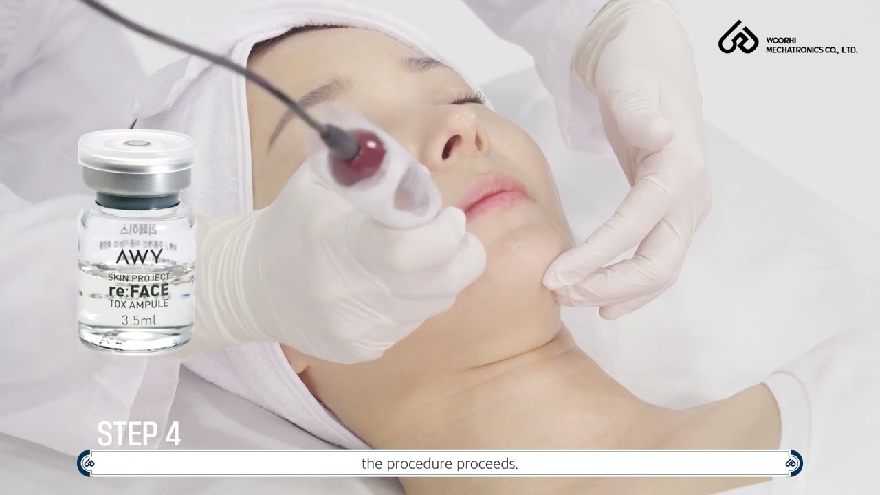 Raffine how to use_microneedling treatment