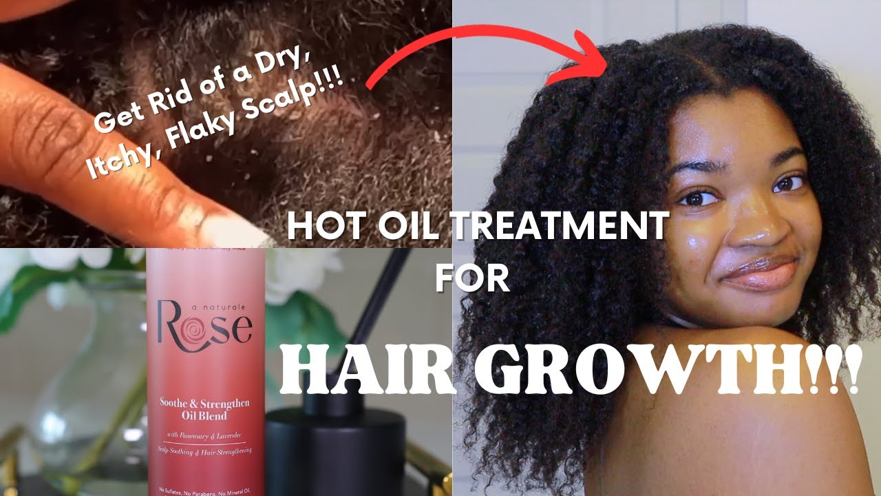 Hot Oil Treatment for HAIR GROWTH!!! | Get Rid of Dry, Flaky, Itchy SCALP!!! | ft. A Naturale Rose