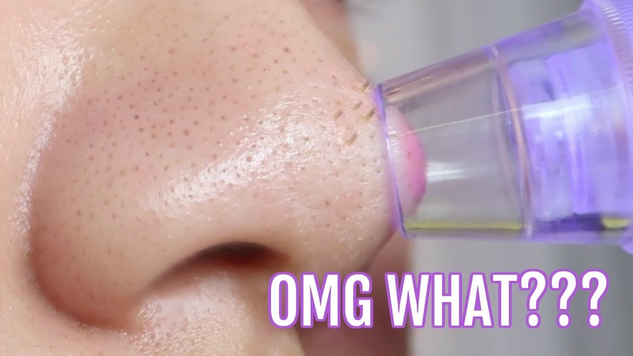 I didnt expect that... NEW Pore + Blackhead SUCKING Vacuum!
