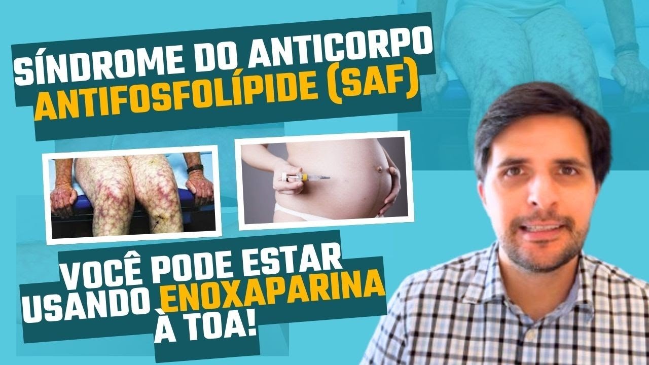 Junta (#13) - SAF: A síndrome antifosfolípide - talvez você nao precise usar essa enoxaparina