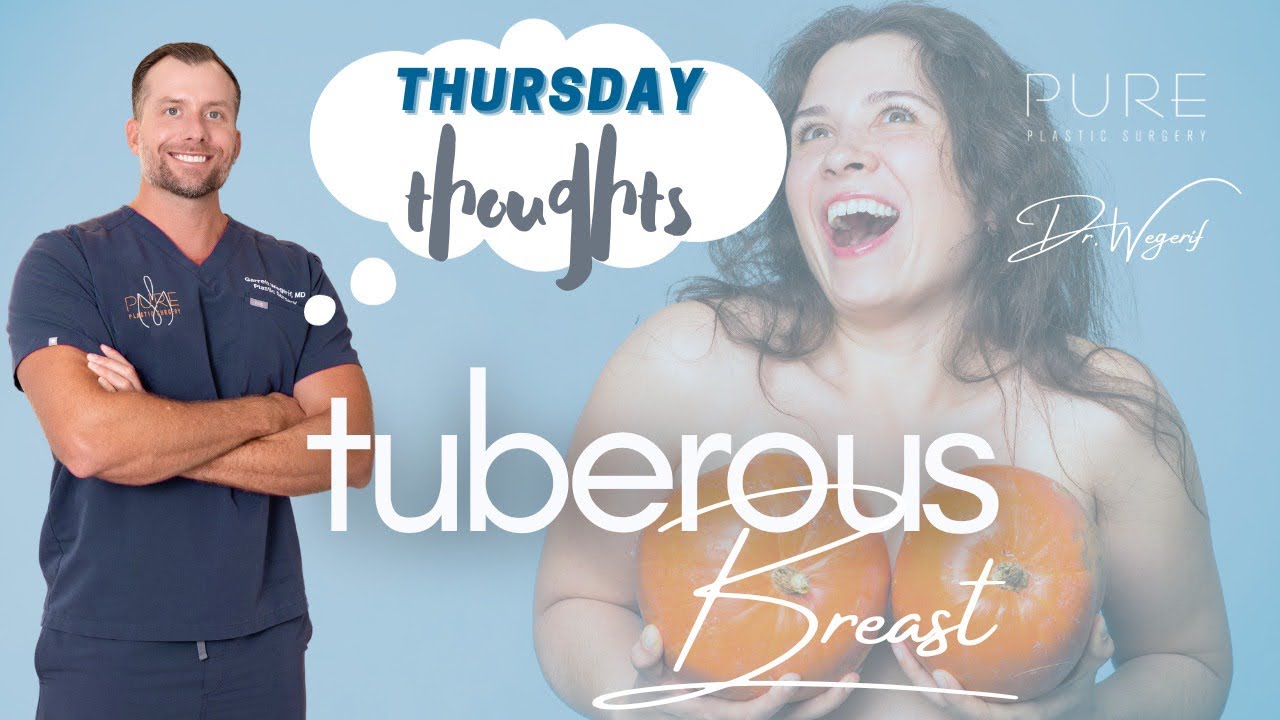 Thursday Thoughts: Tuberous Breast