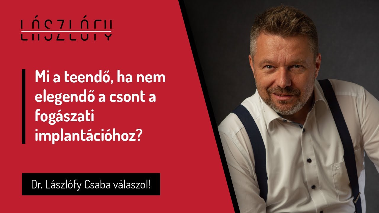 Mi a teendő, ha nem elegendő a csont a fogászati implantációhoz? Csontpótlás, de miért?