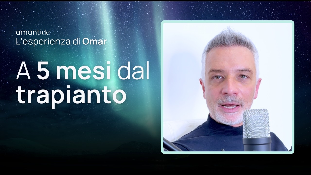 Omar e il trapianto di capelli dopo 5 mesi | Amantide