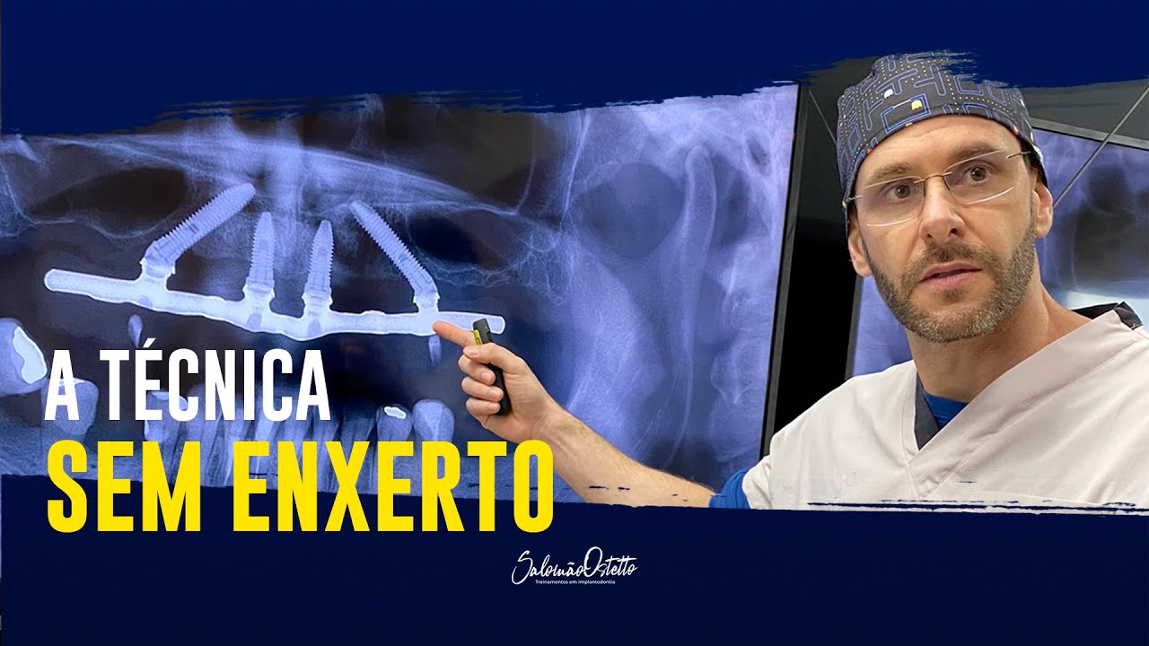 AULA - A TÉCNICA SEM ENXERTO - DR. SALOMÃO OSTETTO