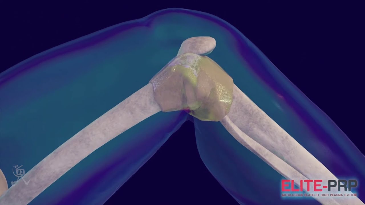 knee treatment medical 3d animation