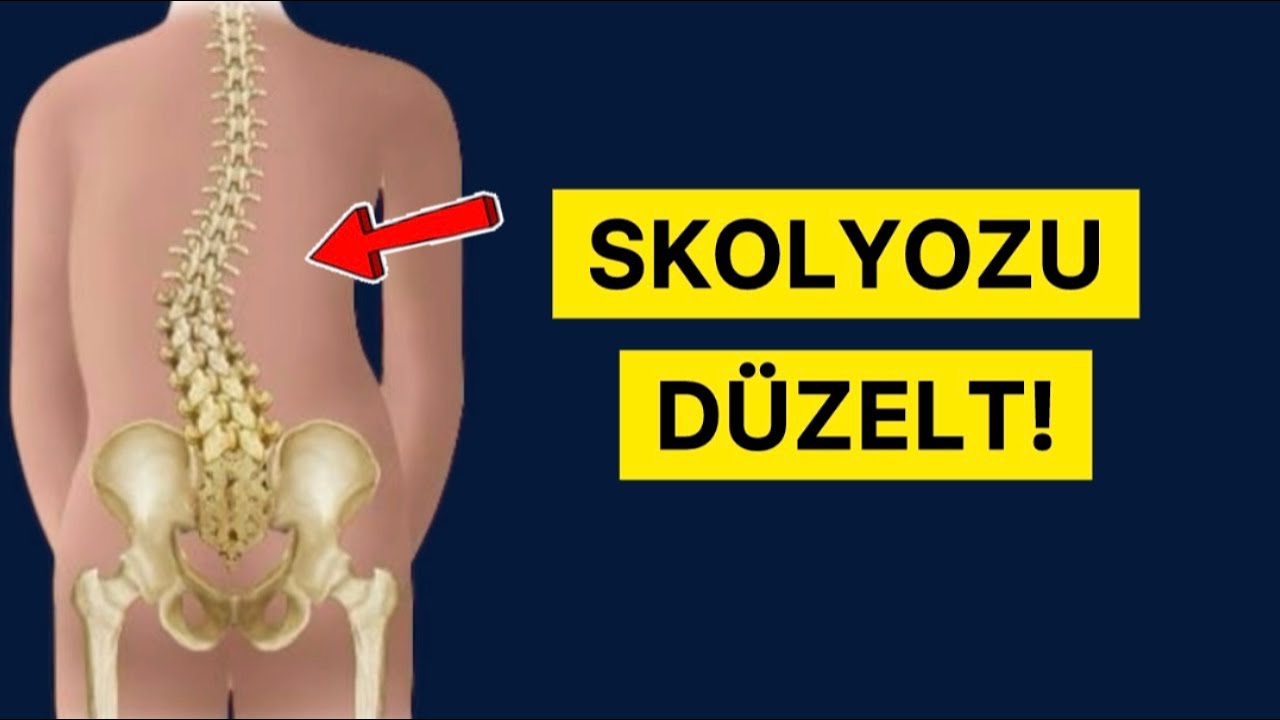 SKOLYOZU-OMURGA EĞRİLİĞİNİ DÜZELT! #fizyoterapistmacide
