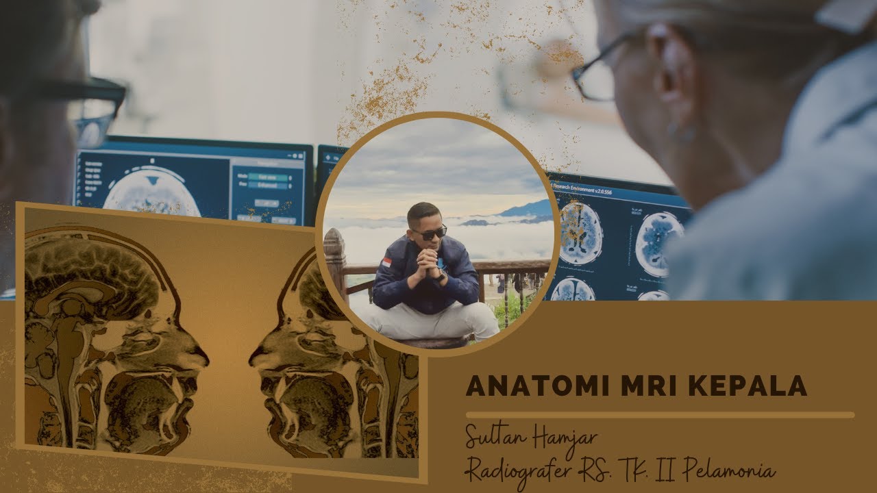 Teknik Pemeriksaan MRI Kepala