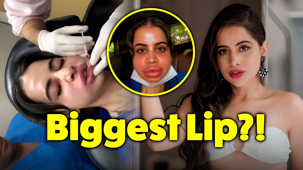 Urfi Javed Removes Her Lip Fillers | ISH News
