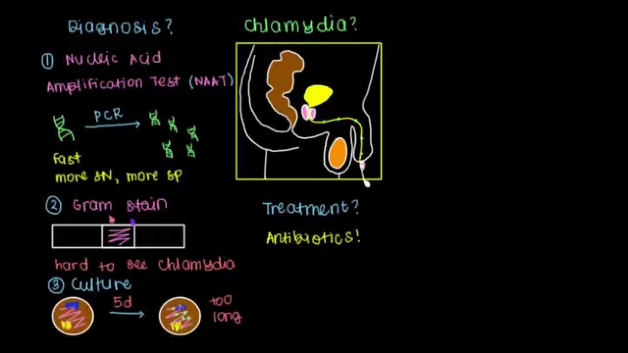 Diagnosis, Treatment, and Prevention of Chlamydia