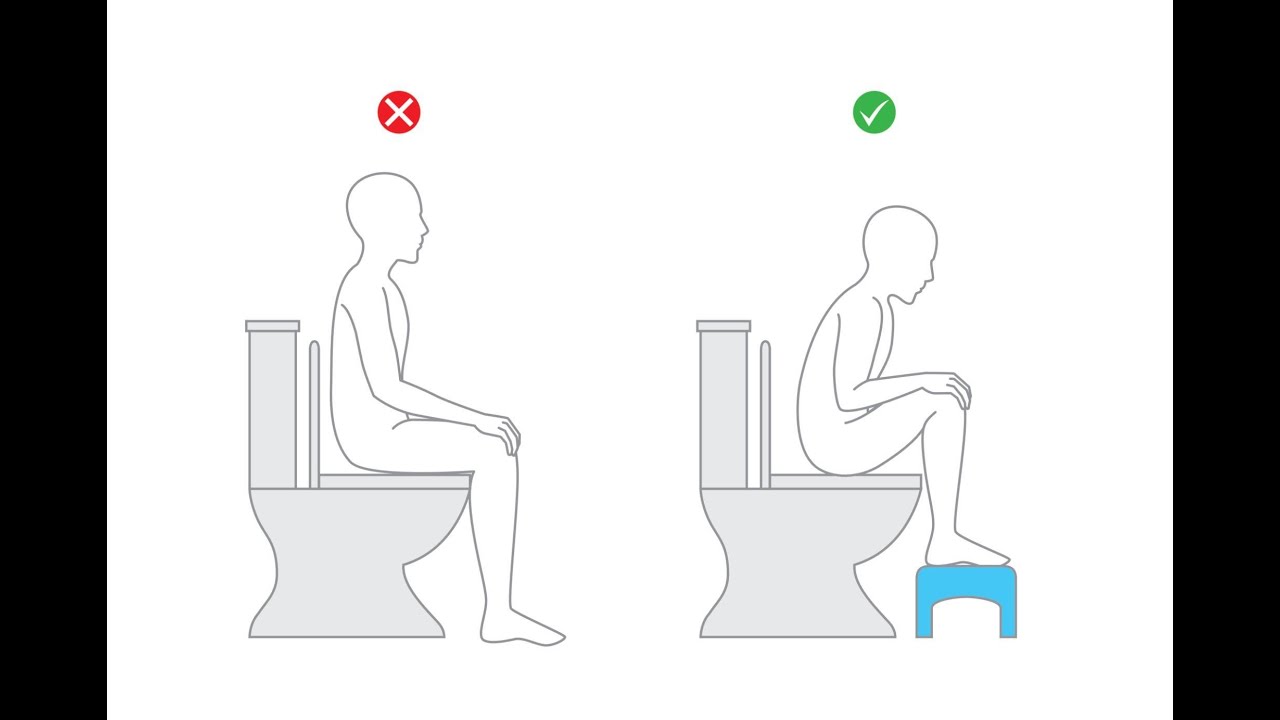 Constipation: How to sit on the toilet (Stop Straining)