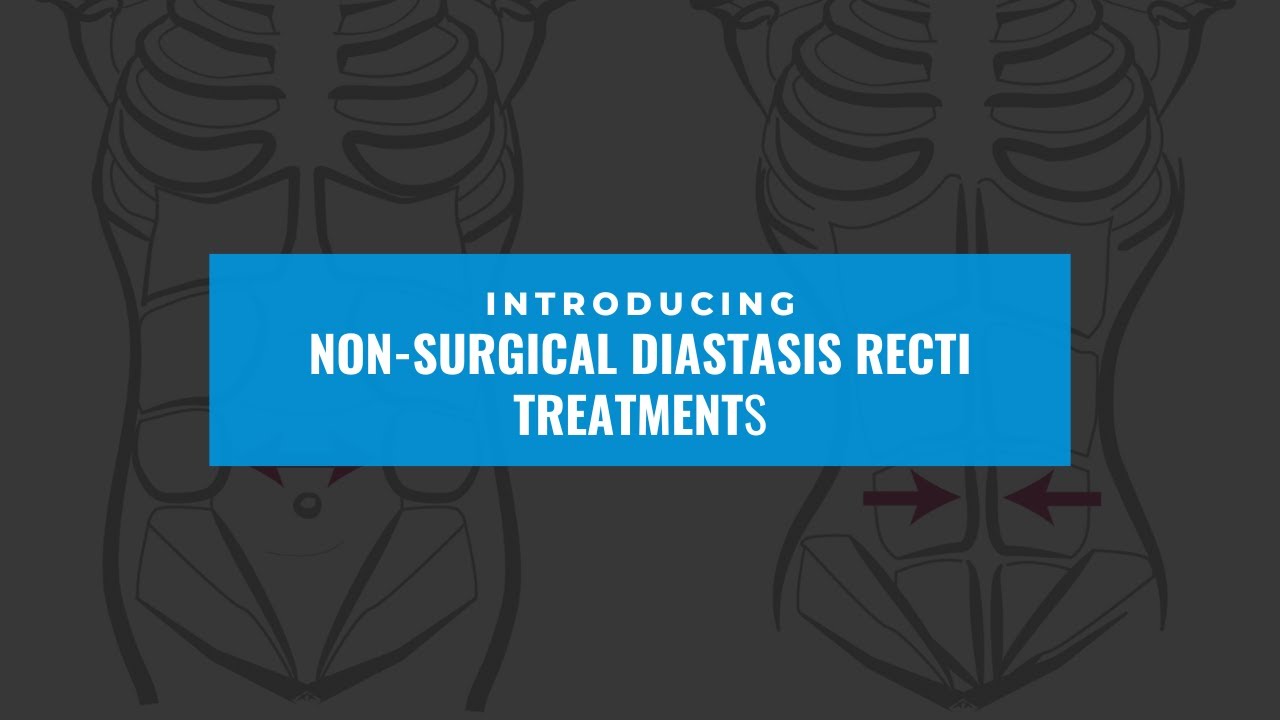 Non-Surgical Diastasis Recti Treatment | Dr. Shounuck Patel