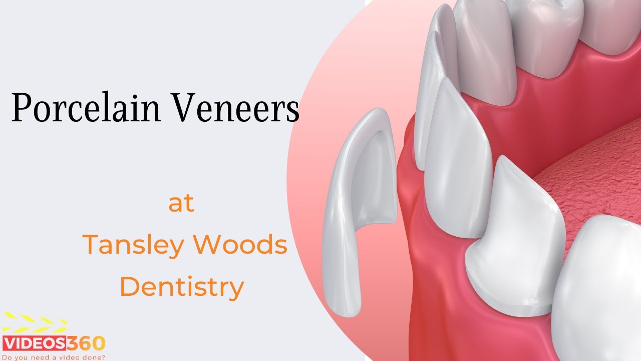Porcelain Veneers at Tansley Woods Dentistry