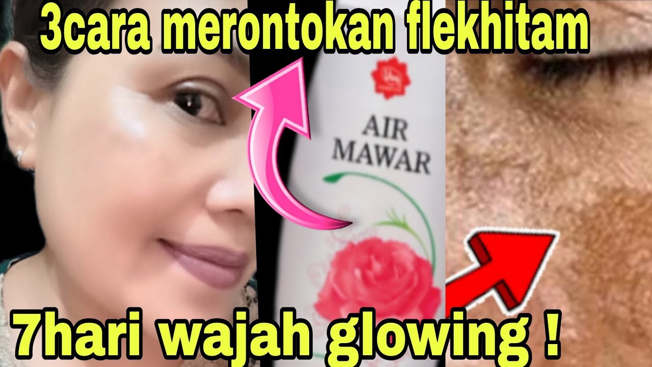 3CARA MERONTOKAN FLEKHITAM DGN TONER AIR MAWAR/Riview