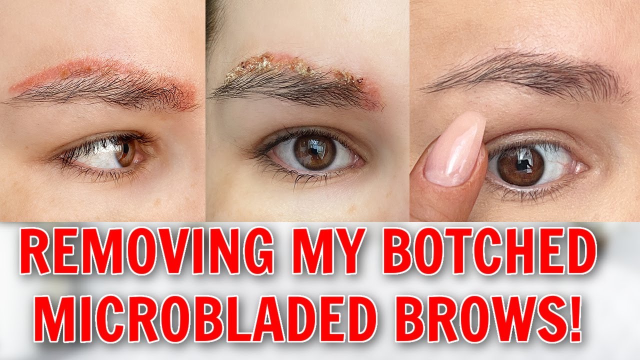 I FINALLY REMOVED MY TATTOOED EYEBROWS ... 😪