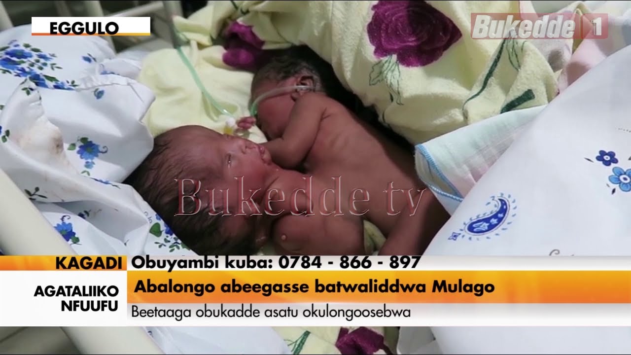 Agataliiko nfuufu: Abalongo abeegasse batwaliddwa Mulago Beetaaga obukadde asatu okubalongoosa.