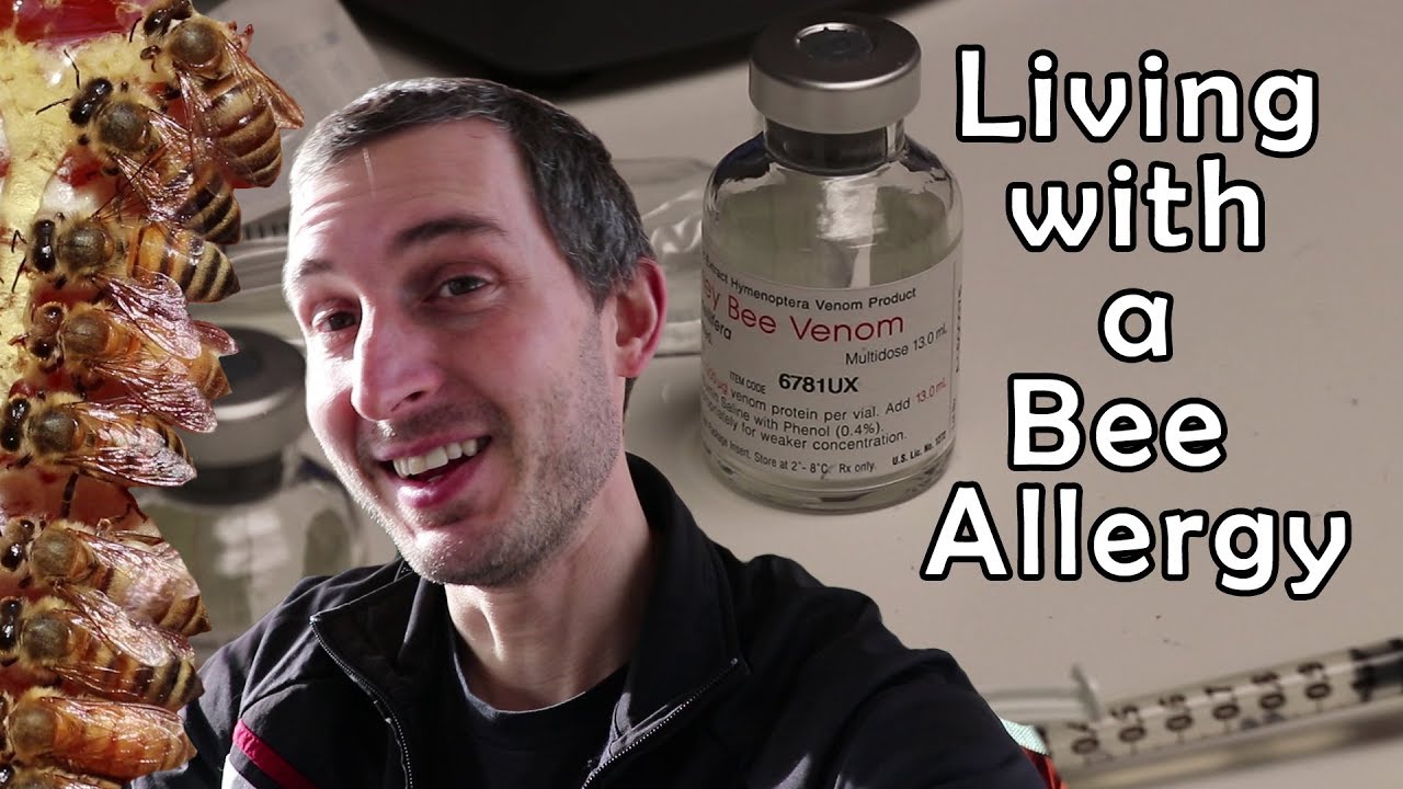Allergic to bees... and I'm a beekeeper