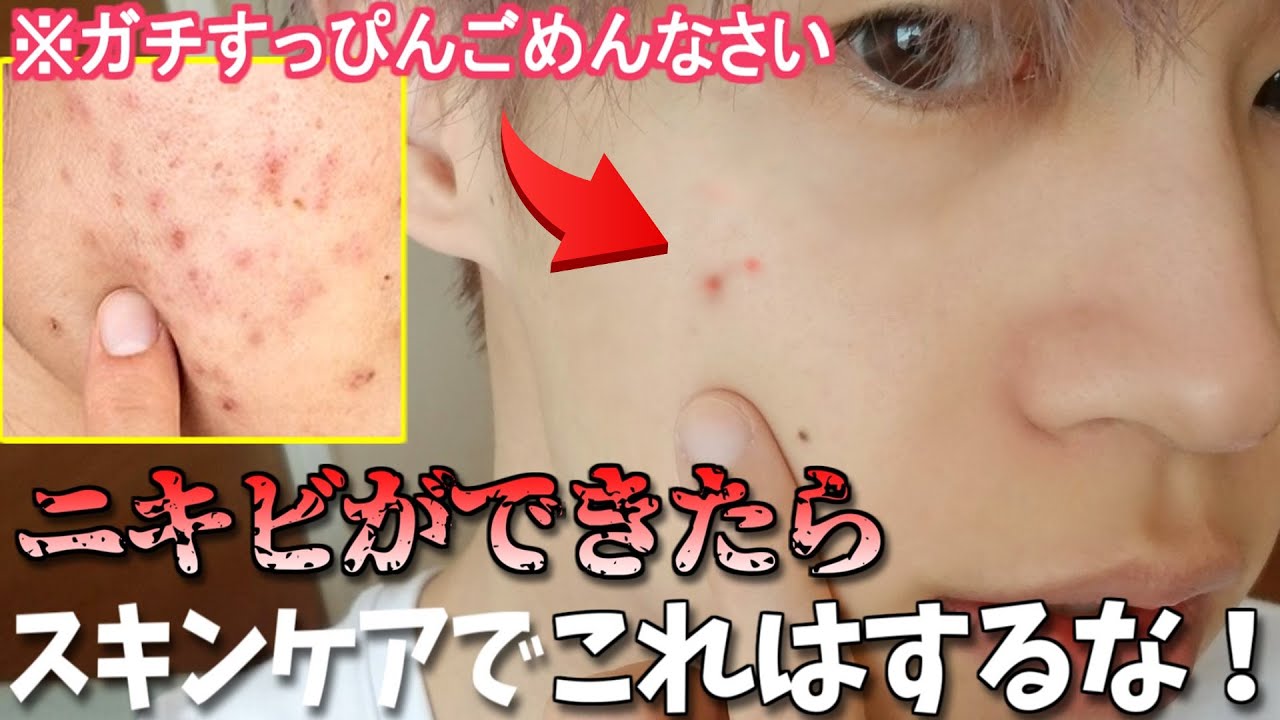 【朝と夜の1軍スキンケア】ニキビを即効で治したい日の1日 (外ロケあり)