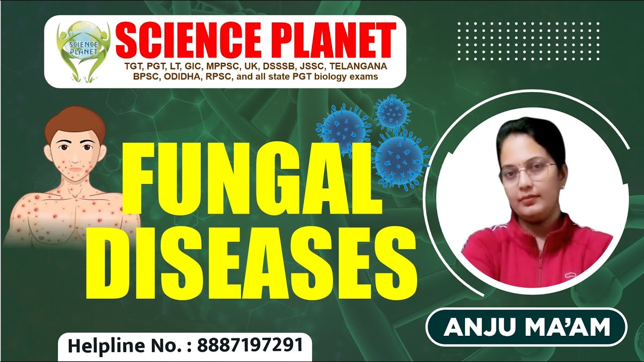 Most Important Fungal Diseases by Anju Mam on Science Planet!