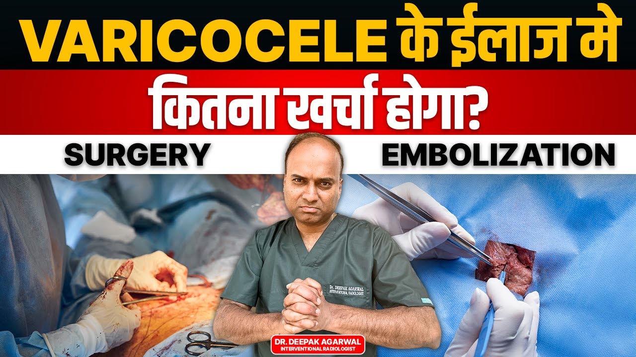 Varicocele Treatment Cost in India | Varicocele के ईलाज मे कितना खर्चा? | Embolization Vs Surgery