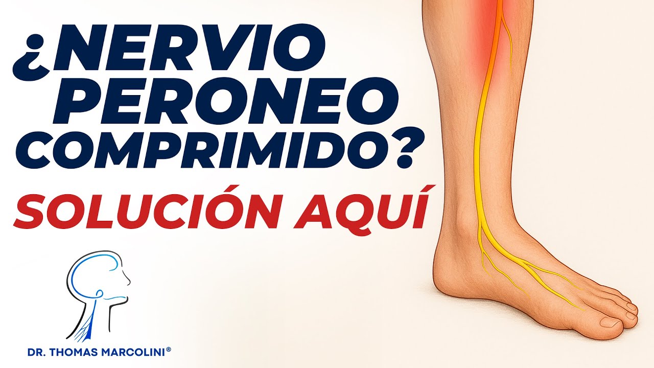 Compresión del Nervio Fibular: ¡Qué Hacer Cuando el Pie Comienza a Caer!