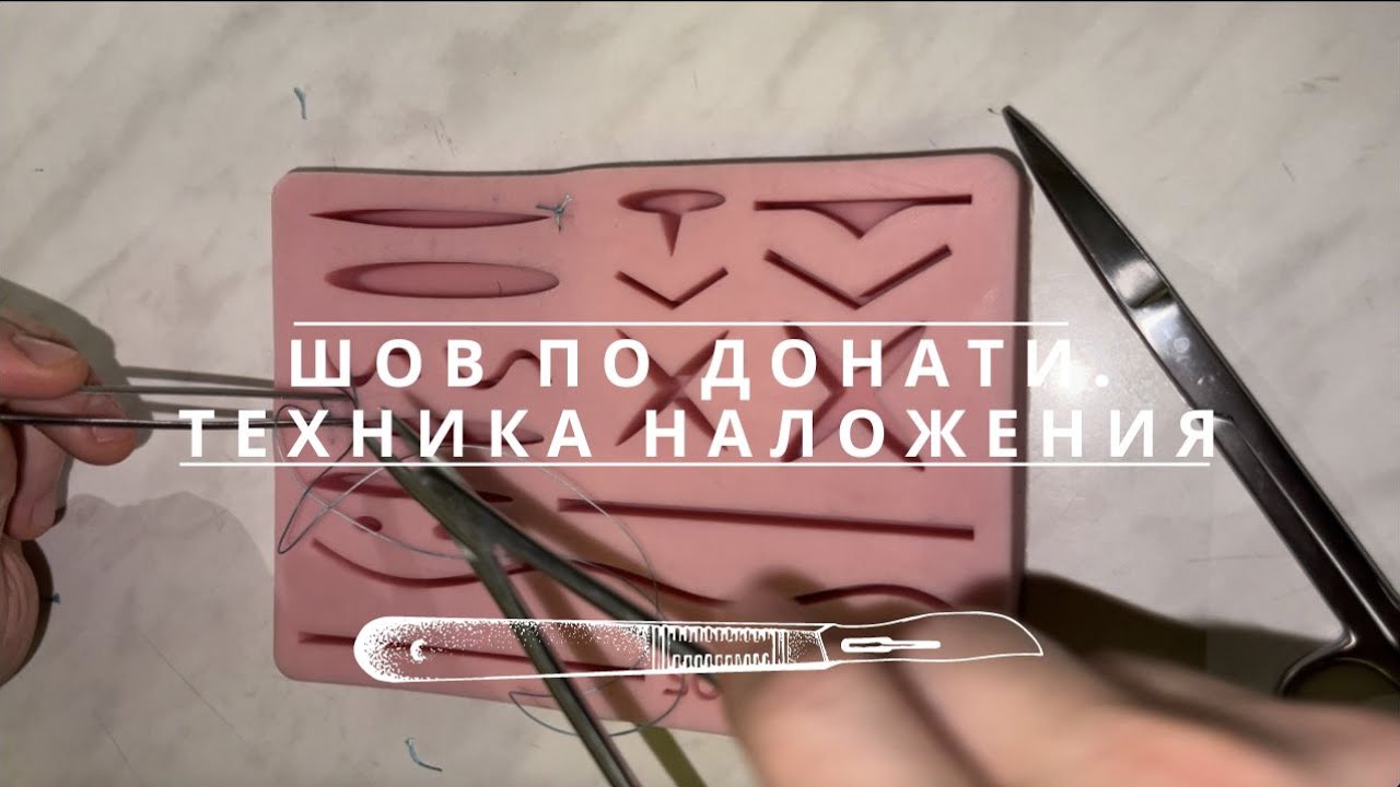 Шов по Донати. Техника наложения.