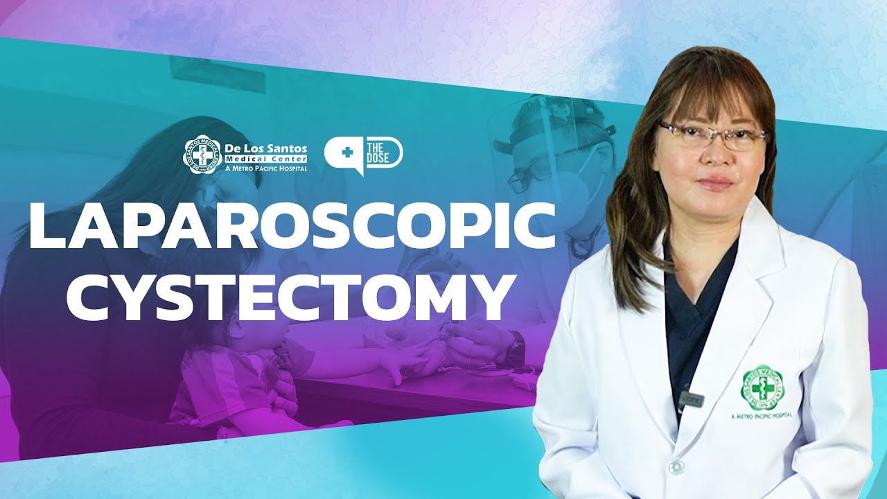 Laparoscopic Cystectomy