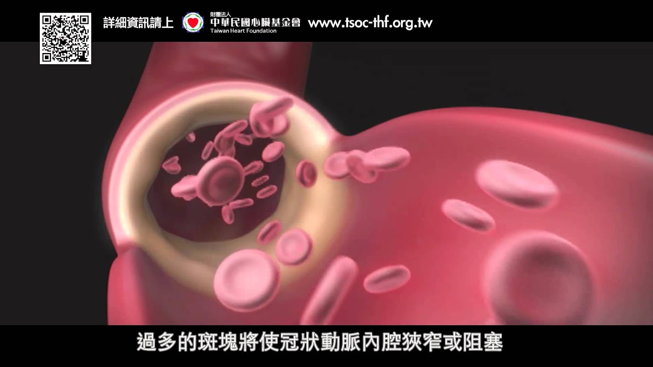 冠心病小學堂part2 &ndash; 擊退十大死因殺手 &ndash; 冠心病