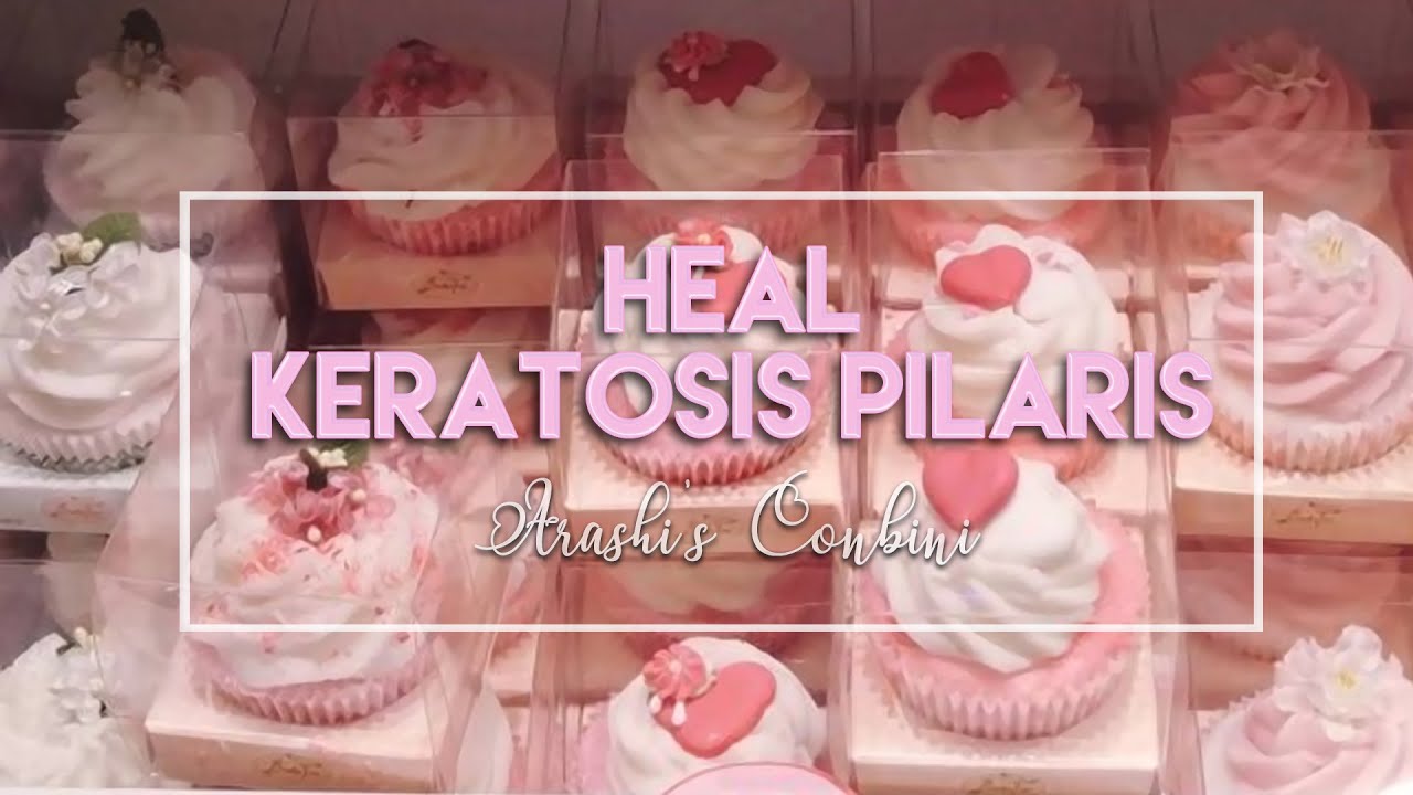 ♡ Heal Keratosis Pilaris ♡