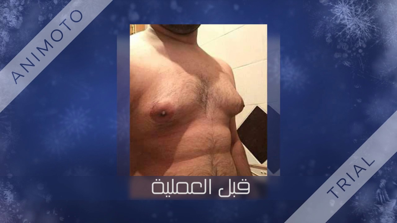 أيها الرجل لدينا حل للتثدي