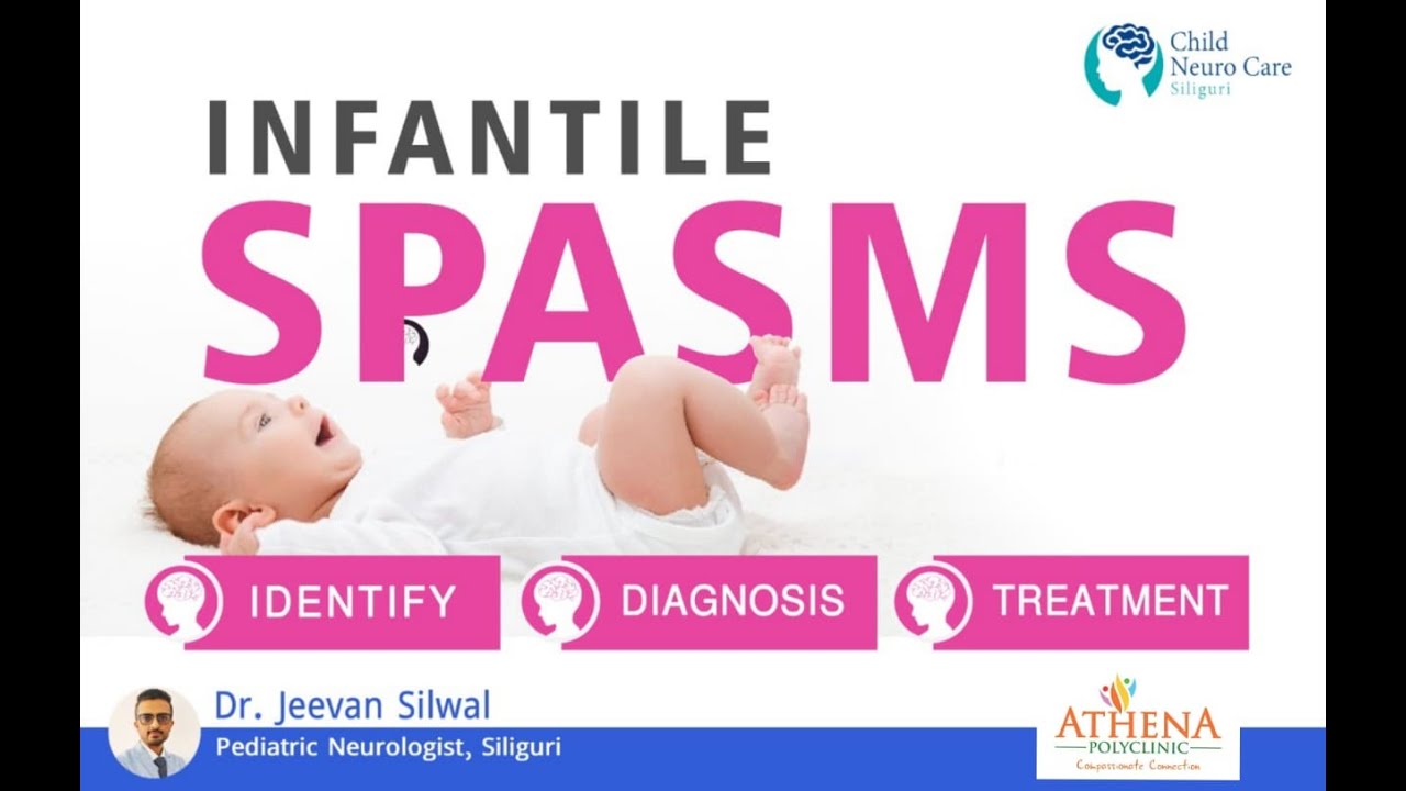 INFANTILE SPASMS: SYMPTOMS, DIAGNOSIS AND TREATMENT