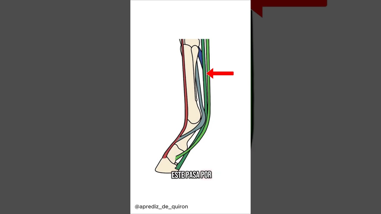 Tendones y ligamentos del equino 🐴