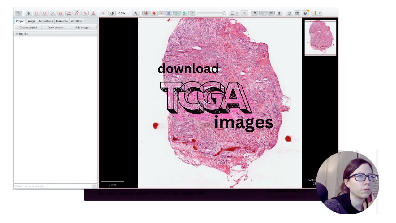 Download cancer images from TCGA