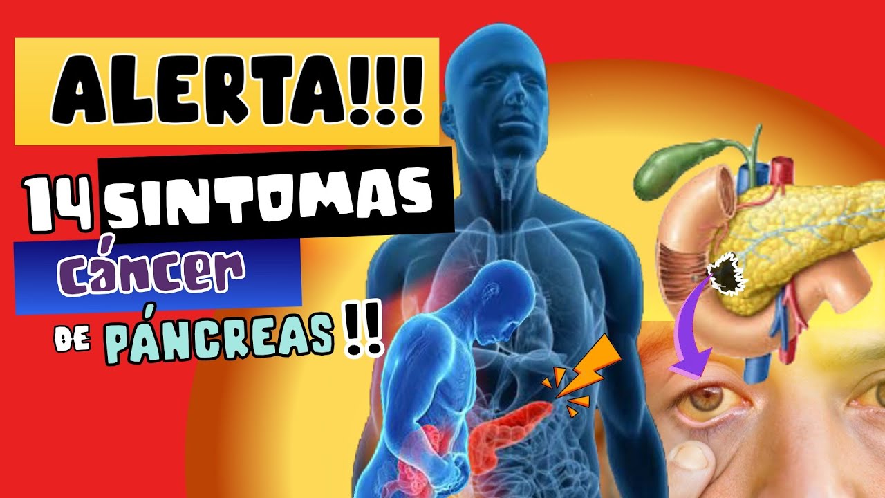 CUIDADO ⚠️ LO QUE DEBEMOS SABER SOBRE EL CÁNCER DE PÁNCREAS !!!