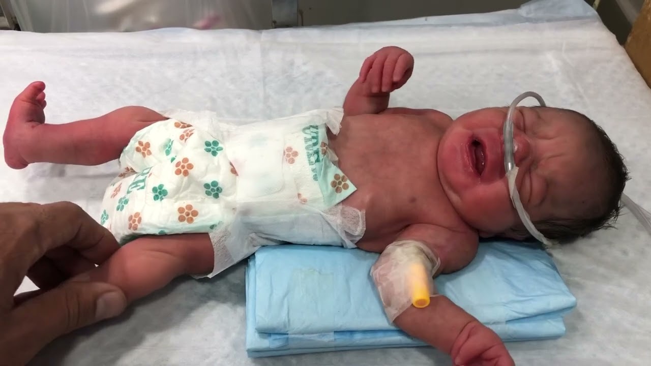  28 Weeks Premature Baby 💕 Condition Improving | NICU Miracle & Recovery Journey