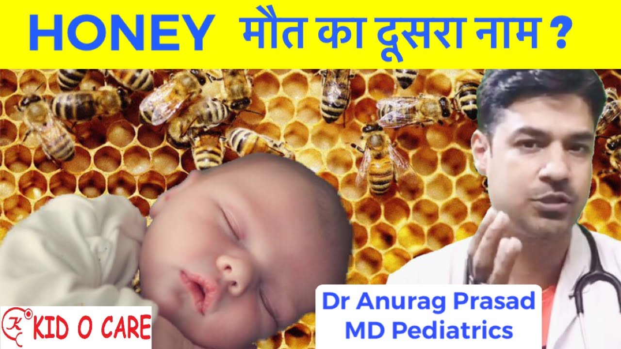 Honey Botulism Baby | Botulism Paralysis | Infant Botulism | Dr Anurag Prasad | vlog17